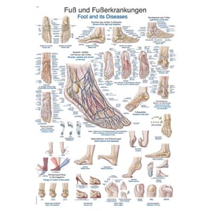 Plakat anatomisk "Fot og lidelser" 70x100cm