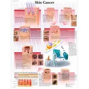 Plakat Anatomisk "Skin cancer" 50x67 cm