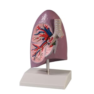 Lunge, halv med bronkie, arterier og vener
