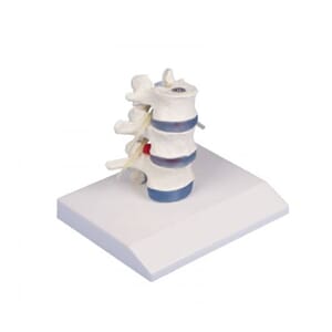 Lumbal vertebral med 3 ryggvirvler, 4047