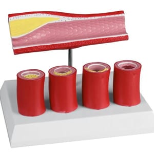 Arterie modell med 4 arterieseksjoner