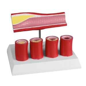 Arterie modell med 4 arterieseksjoner